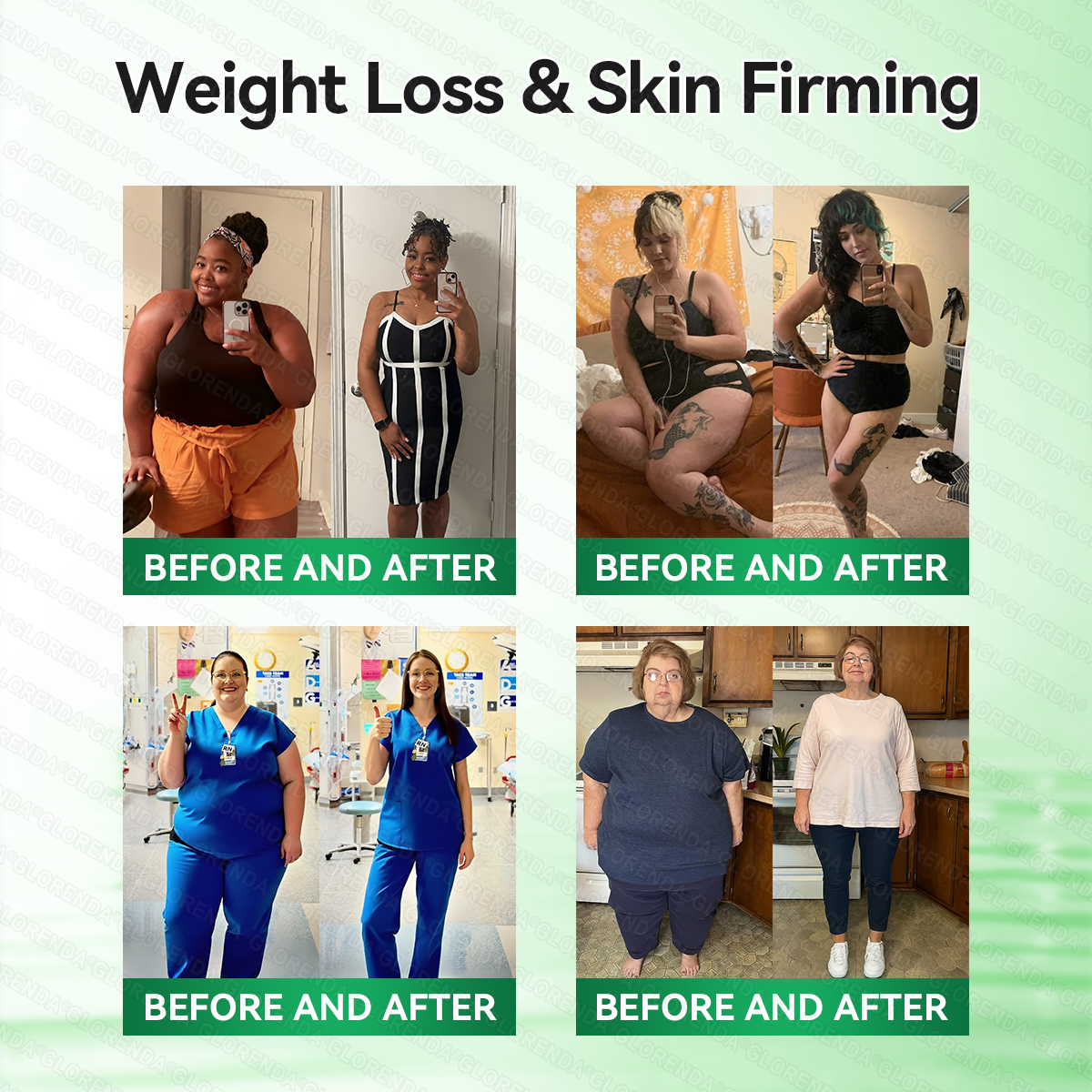 𝑶𝒇𝒇𝒊𝒄𝒊𝒂𝒍 𝑺𝒕𝒐𝒓𝒆  🧑‍⚕️💃𝐆𝐋𝐎𝑹𝑬𝑵𝑫𝗔®𝑴𝒐𝒓𝒊𝒏𝒈𝗮 · 𝗕𝗲𝗿𝗯𝗲𝗿𝙞𝙣𝙚 × 𝙉𝘼𝐃+ 𝟏𝟎-𝐢𝐧-𝟏 𝗔𝗱𝘃𝗮𝗻𝗰𝙚𝙙 𝙉𝙖𝙣𝙤 𝙈𝙞𝙘𝙧𝙤𝙣𝙚𝙚𝐝𝐥𝐞 𝐏𝐚𝐭𝙘𝙝(𝐉𝐮𝐬𝐭 𝐨𝐧𝐜𝐞 𝐚 𝐝𝐚𝐲, 𝐯𝐢𝐬𝐢𝐛𝐥𝐞 𝐜𝐡𝐚𝐧𝐠𝐞𝐬 𝐢𝐧 𝟕 𝐝𝐚𝐲𝐬） ✅ 𝐅𝐨𝐫 𝐨𝐛𝐞𝐬𝐢𝐭𝐲, 🅛🅞🅞🅢🅔 🅢🅚🅘🅝,𝐝𝐢𝐚𝐛𝐞𝐭𝐞𝐬, 𝐬𝐥𝐞𝐞𝐩 𝐚𝐩𝐧𝐞𝐚, 𝐣𝐨𝐢𝐧𝐭 𝐢𝐬𝐬𝐮𝐞𝐬, 𝐚𝐧𝐝 𝐦𝐨𝐫𝐞