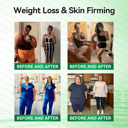 𝑶𝒇𝒇𝒊𝒄𝒊𝒂𝒍 𝑺𝒕𝒐𝒓𝒆  🧑‍⚕️💃𝐆𝐋𝐎𝑹𝑬𝑵𝑫𝗔®𝑴𝒐𝒓𝒊𝒏𝒈𝗮 · 𝗕𝗲𝗿𝗯𝗲𝗿𝙞𝙣𝙚 × 𝙉𝘼𝐃+ 𝟏𝟎-𝐢𝐧-𝟏 𝗔𝗱𝘃𝗮𝗻𝗰𝙚𝙙 𝙉𝙖𝙣𝙤 𝙈𝙞𝙘𝙧𝙤𝙣𝙚𝙚𝐝𝐥𝐞 𝐏𝐚𝐭𝙘𝙝(𝐉𝐮𝐬𝐭 𝐨𝐧𝐜𝐞 𝐚 𝐝𝐚𝐲, 𝐯𝐢𝐬𝐢𝐛𝐥𝐞 𝐜𝐡𝐚𝐧𝐠𝐞𝐬 𝐢𝐧 𝟕 𝐝𝐚𝐲𝐬） ✅ 𝐅𝐨𝐫 𝐨𝐛𝐞𝐬𝐢𝐭𝐲, 🅛🅞🅞🅢🅔 🅢🅚🅘🅝,𝐝𝐢𝐚𝐛𝐞𝐭𝐞𝐬, 𝐬𝐥𝐞𝐞𝐩 𝐚𝐩𝐧𝐞𝐚, 𝐣𝐨𝐢𝐧𝐭 𝐢𝐬𝐬𝐮𝐞𝐬, 𝐚𝐧𝐝 𝐦𝐨𝐫𝐞